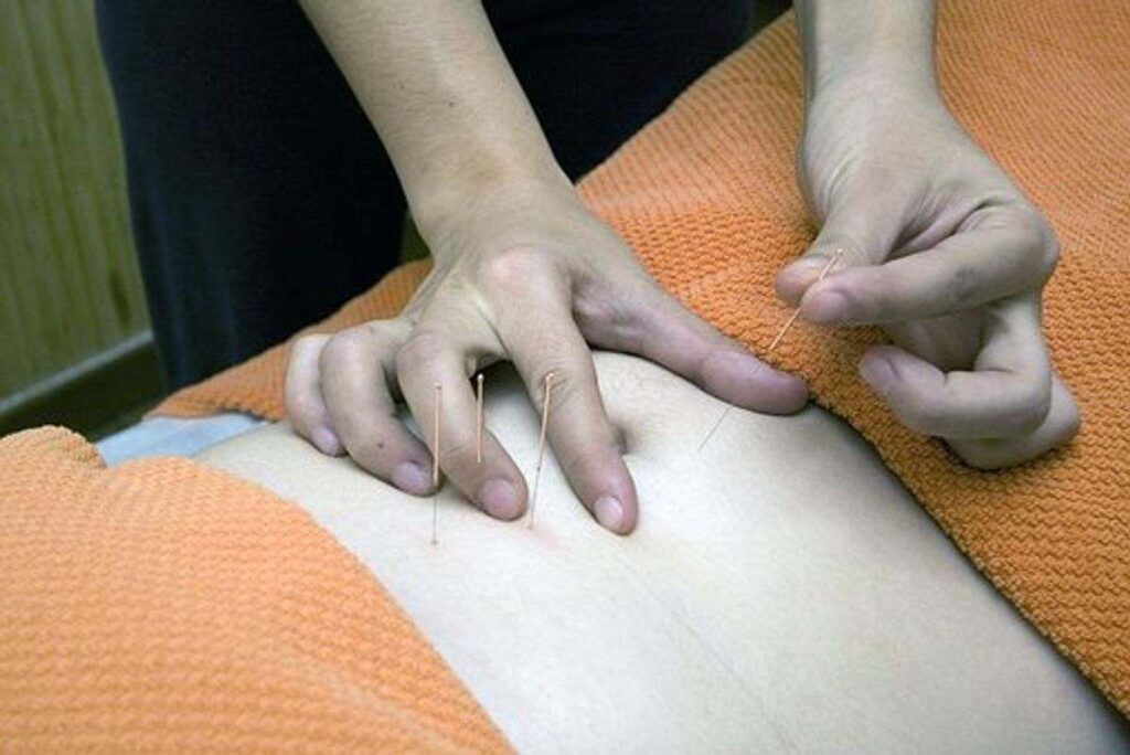 How Does Acupuncture Work