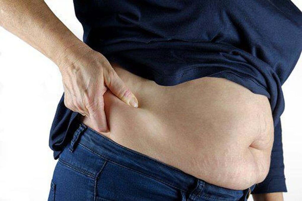 Obesity and How to Overcome It
