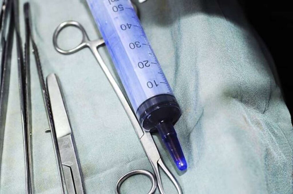 fistula