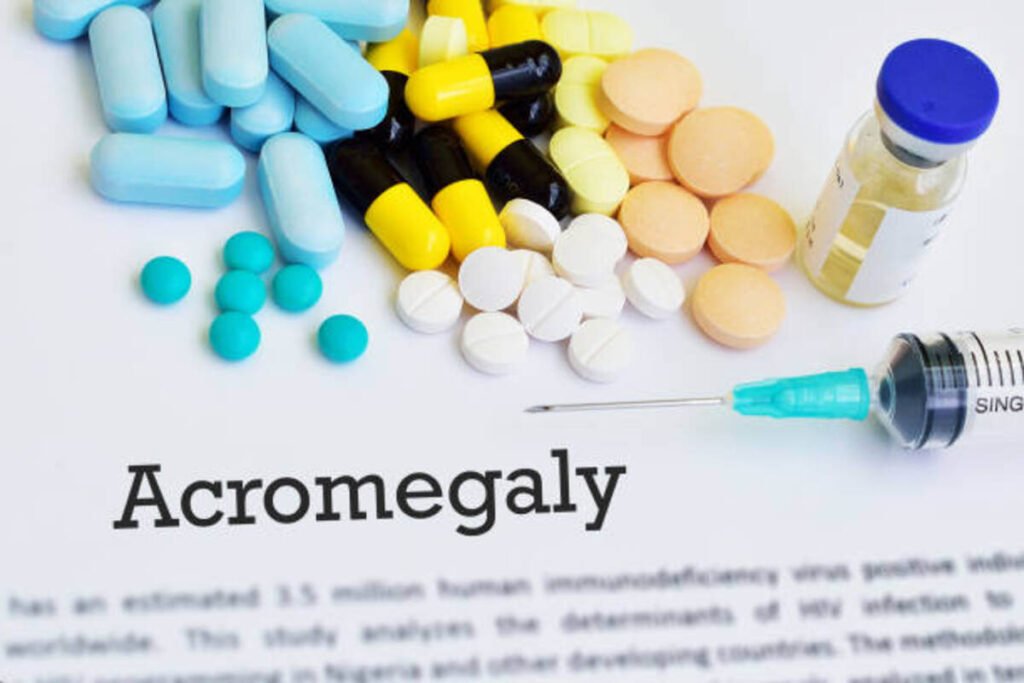 acromegaly