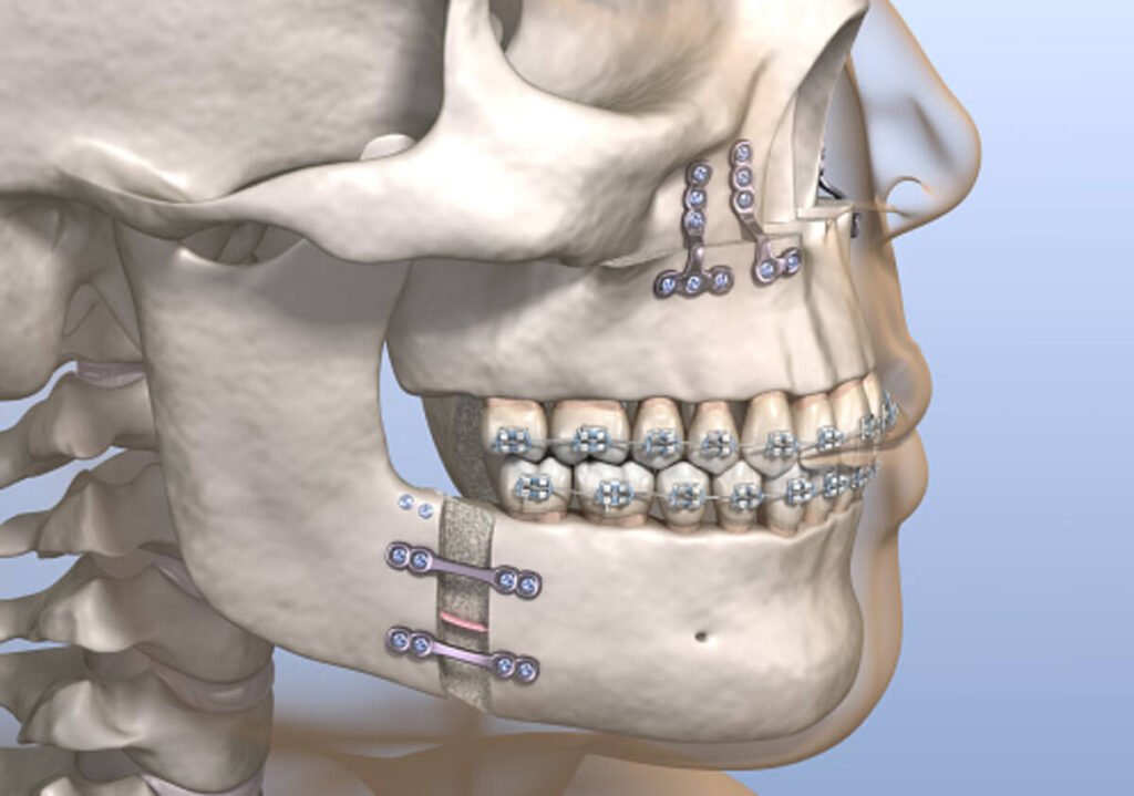 how to fix facial asymmetry naturally