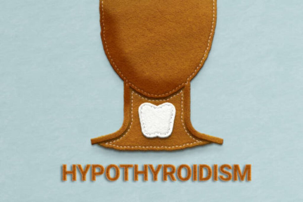 hypothyroidism symptoms