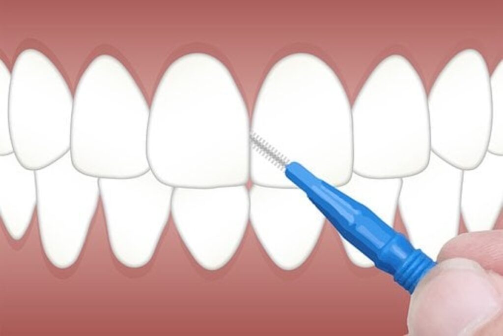 aspen dental financing reviews