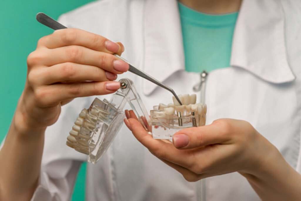 mini dental implants reviews