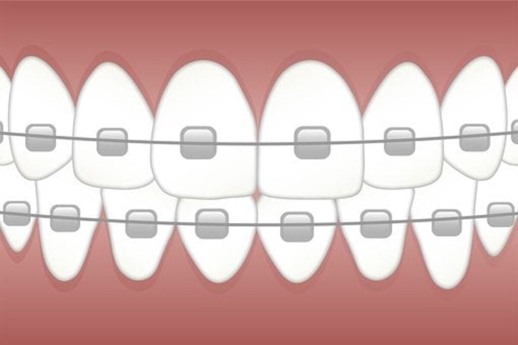 orthodontist reviews